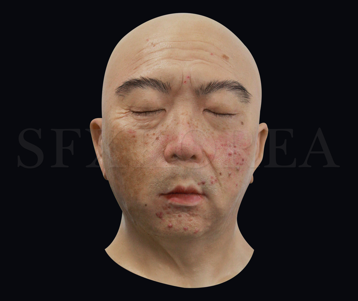 실리콘 머리모형 - 남성2(피부 질환이 표현된 실리콘 얼굴모형)