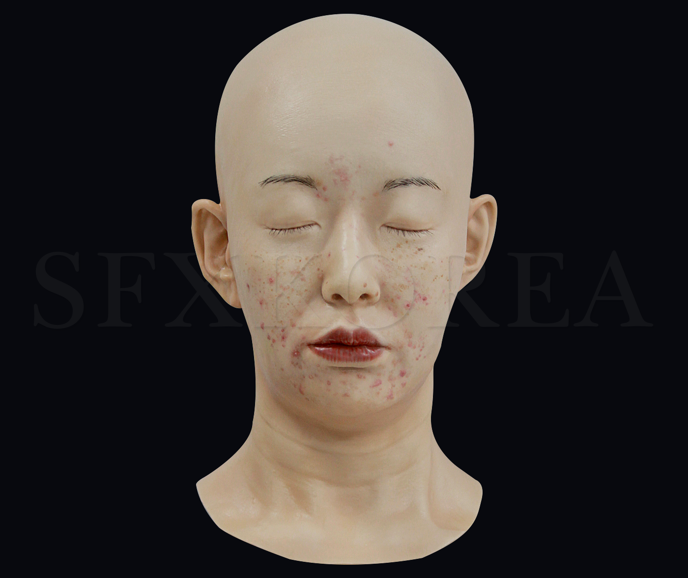 실리콘 머리모형 - 여성6(피부질환:여드름이 표현된 실리콘 얼굴모형)